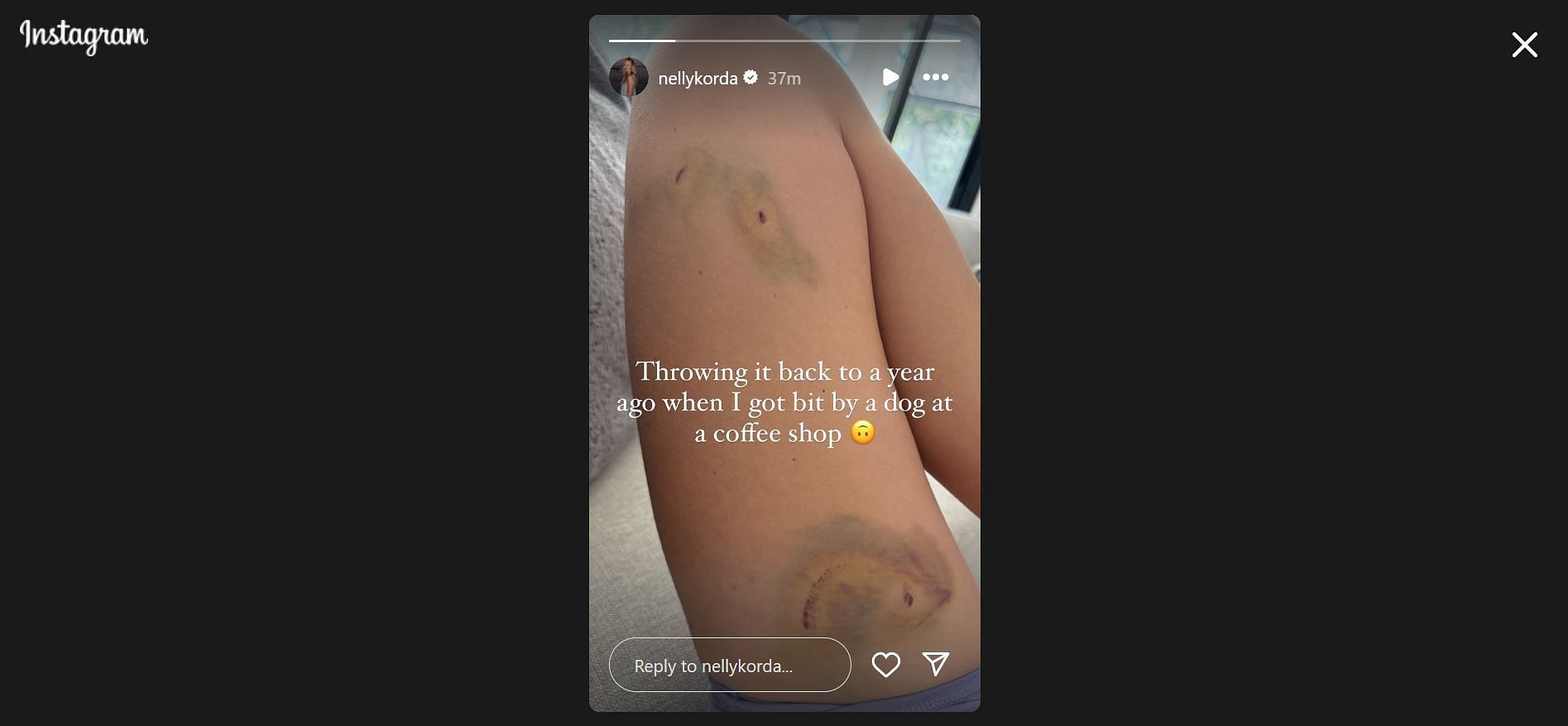 Nelly Korda recalls her dog bite from last year (Image Credit: IG @nellykorda)